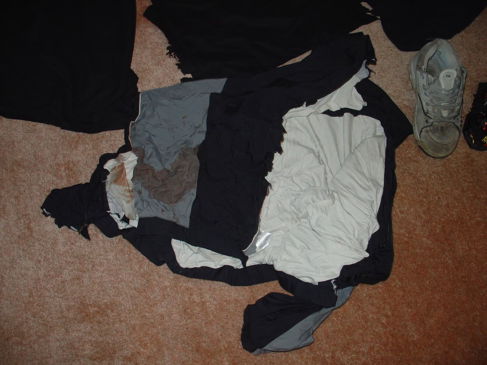 Close-up of Andrew's torn clothing from the accident
